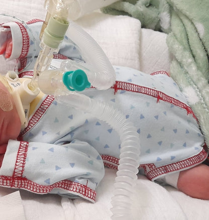 Ein Neugeborenes liegt auf einer weichen Unterlage, trägt einen hellblauen Strampler/Body für Sonden, Kabel und Schläuche mit kleinen Dreiecken und roten Nähten und ist an eine Atemunterstützung mit einem Beatmungsschlauch angeschlossen. Eine grüne Decke ist im Hintergrund zu sehen.